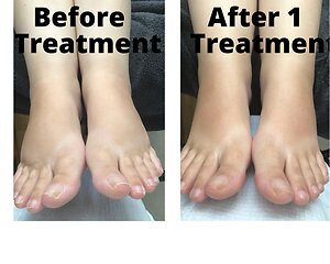 RLD, Reflexology Lymph Drainage. Therapy. Catherine RLD 