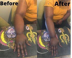 RLD, Reflexology Lymph Drainage. Therapy. Sadie RLD Treatment