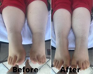 RLD, Reflexology Lymph Drainage. Therapy. Lauren RLD 